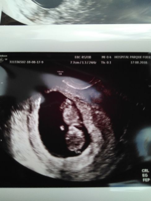 Futuras mamás marzo 2019 - 2