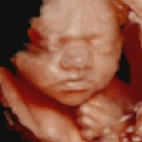 Futuras mamás marzo 2019 - 1