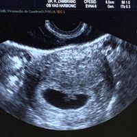 Ayuda con método ramzi: niño o niña? - 1