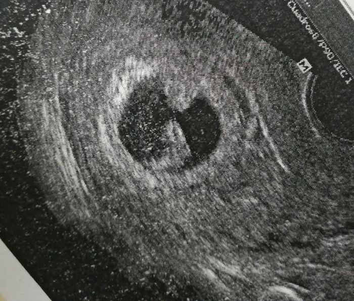 Futuras mamas octubre 2020 - 1