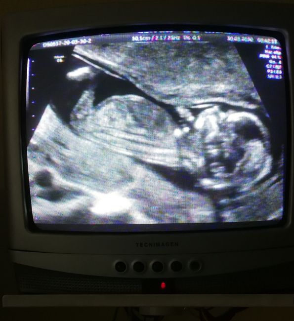Futuras mamas octubre 2020 - 1