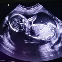 Futuras mamas octubre 2020 - 1