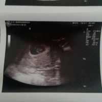 Mamás marzo 2017 - 1