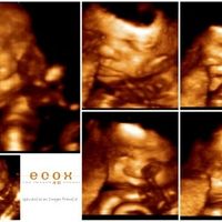 mi gordito.....a las 31 semanas