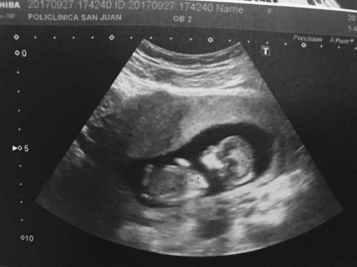  Futuras mamás Abril de 2018! - 1