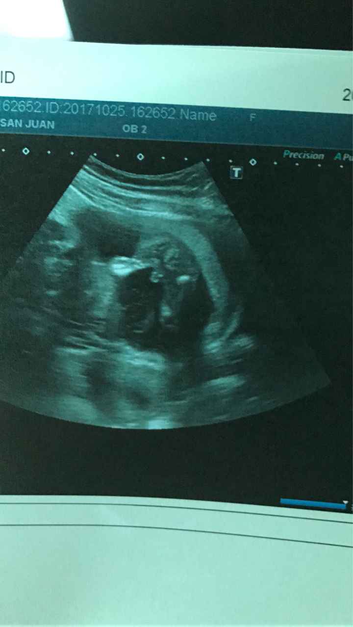  Futuras mamás Abril de 2018! - 1