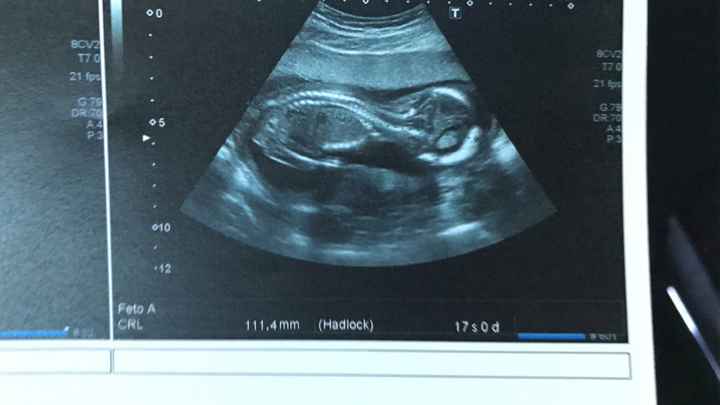  Futuras mamás Abril de 2018! - 2
