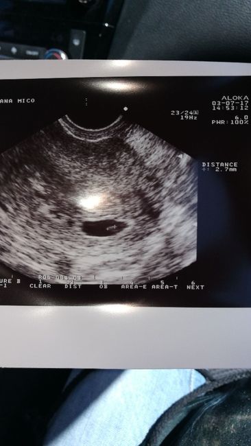 Buscadoras después de uno o varios abortos ii - 1
