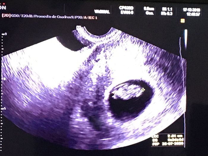 Futuras Mamas Julio 2020. - 1