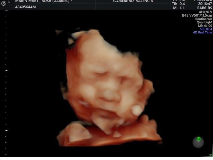 Futuras Mamas Julio 2020. - 1