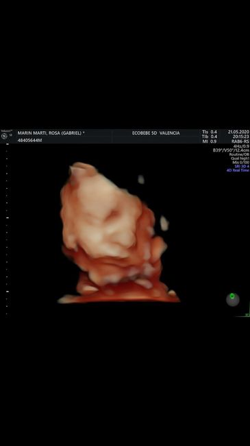 Futuras Mamas Julio 2020. - 2