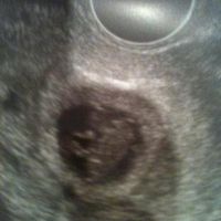 primera foto de mi bebe