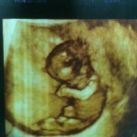 mi bebe 11 semanas