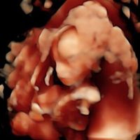  Futuras mamás Abril de 2018! - 1