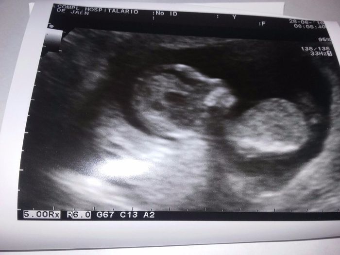 Mi bollito, mamis de Enero