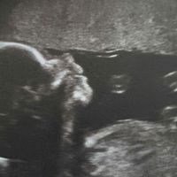 Futuras mamas julio 2019 - 1