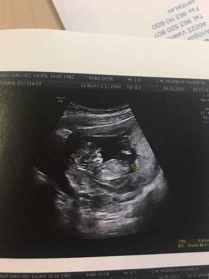 Tubérculo genital niño o niña??? - 1