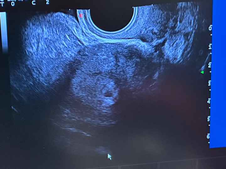 Futuras Mamás Octubre 2023 (provisional) 🤰🏽🤩♥️ - 1