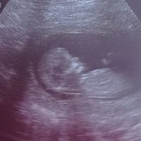 Futuras mamis Enero 2022 - 1