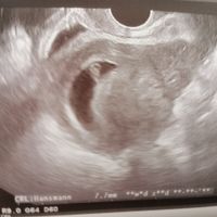 Futuras mamás octubre 2021 - 1