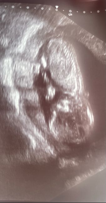 Niño o niña 2
