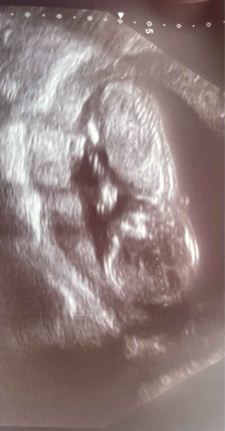 Niño o niña - 2