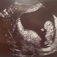Niño o niña - 1