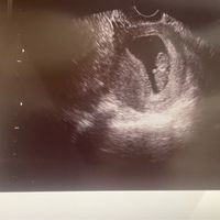 Niño o niña - 2