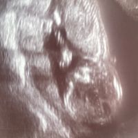 Niño o niña - 2