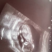 Niño o niña - 2