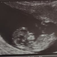¿qué veis en mi eco? la de arriba es la mia de las 12 semanas y la de abajo es la teoría sobre la co