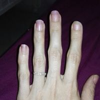 Uñass - 1