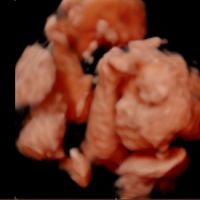 Futuras mamas Diciembre 2020 - 1