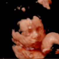 Futuras mamas Diciembre 2020 - 2