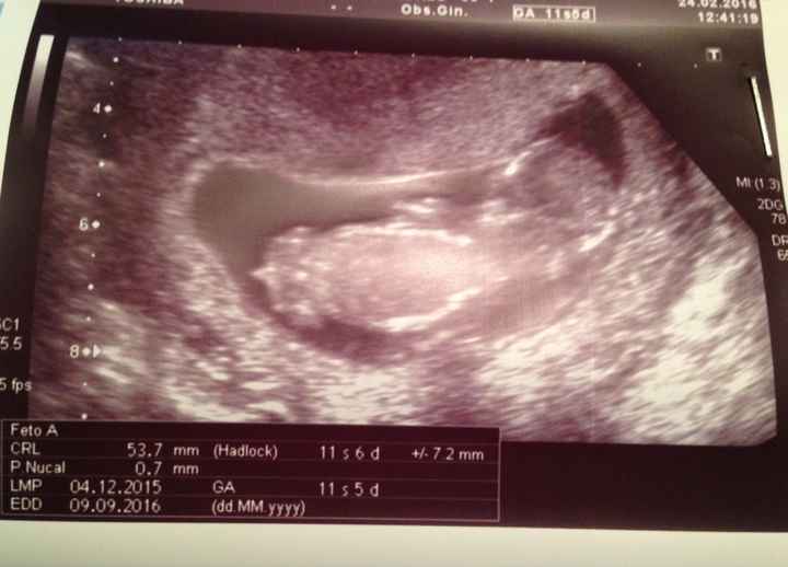 Futuras mamas septiembre 2016 - 1