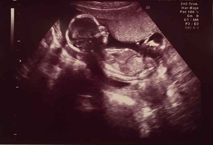 Futuras mamas septiembre 2016 - 1