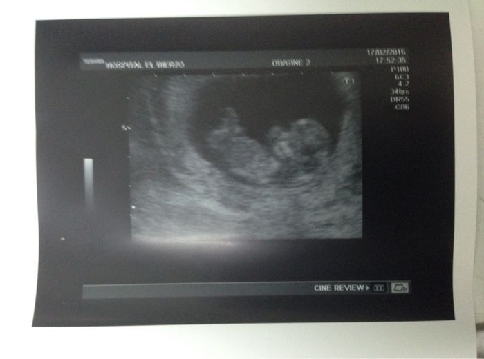 Futuras mamas septiembre 2016 - 1