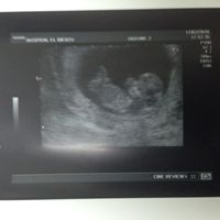 Futuras mamas septiembre 2016 - 1