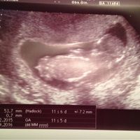 Futuras mamas septiembre 2016 - 1