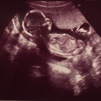 Futuras mamas septiembre 2016 - 1