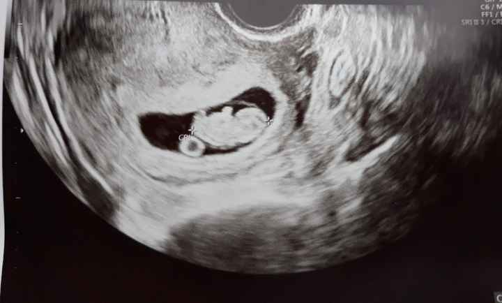 Futuras mamás Diciembre 2018 - 1