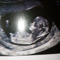 Ayuda con método ramzi: niño o niña? - 2