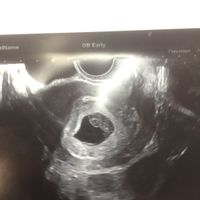 Futuras mamis junio 2021 🤰🏻❤️ oficial - 1