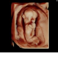Futuras mamis junio 2021 🤰🏻❤️ oficial - 1