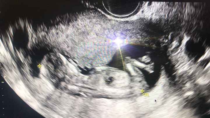 Futuras mamis junio 2021 🤰🏻❤️ oficial - 1