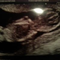 El consultorio de Lita para futuras mamis - 1