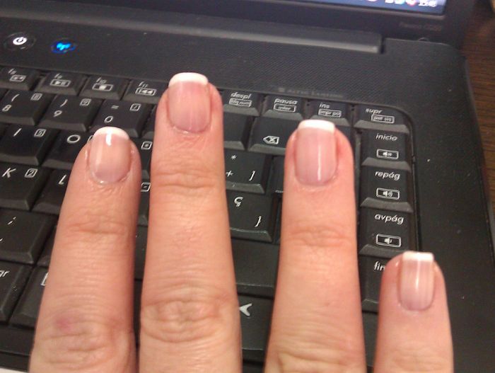 uñass