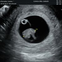 Futuras mamas octubre 2020 - 1