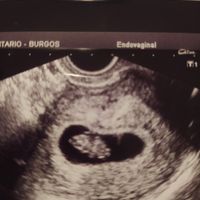 Futuras mamas octubre 2020 - 1