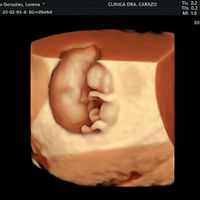 Futuras mamas octubre 2020 - 1
